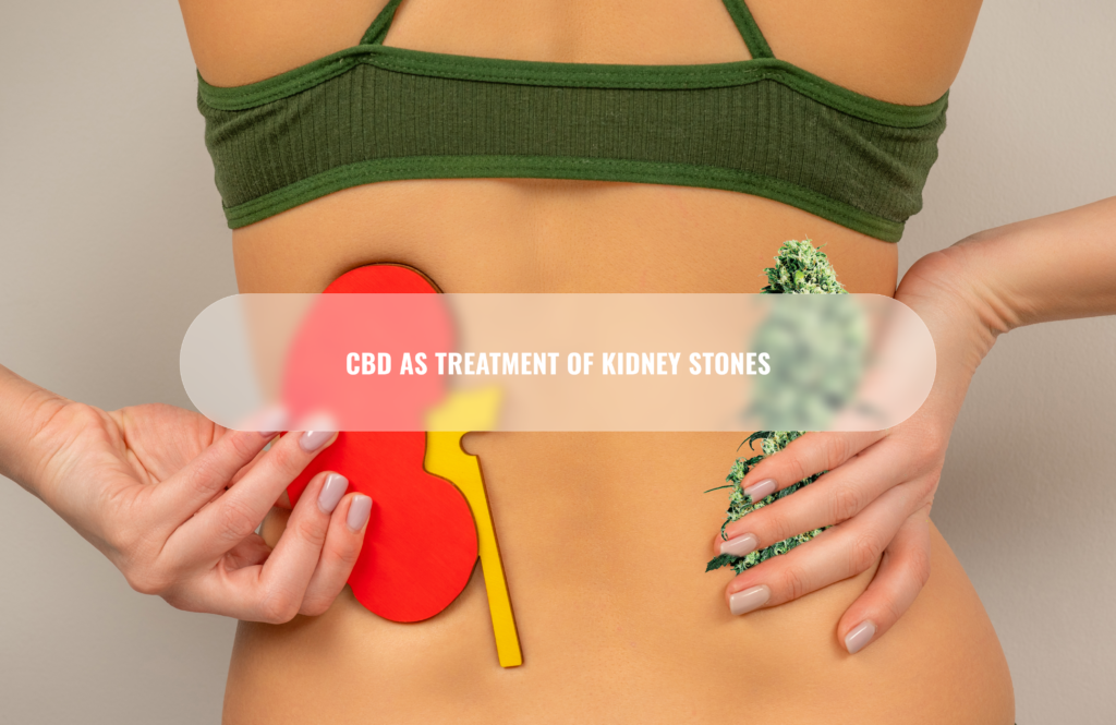 CBD as treatment of kidney stones