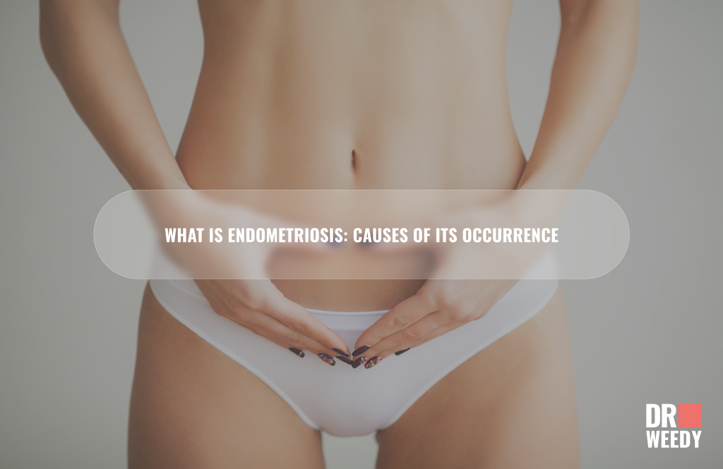 What is endometriosis: causes of its occurrence