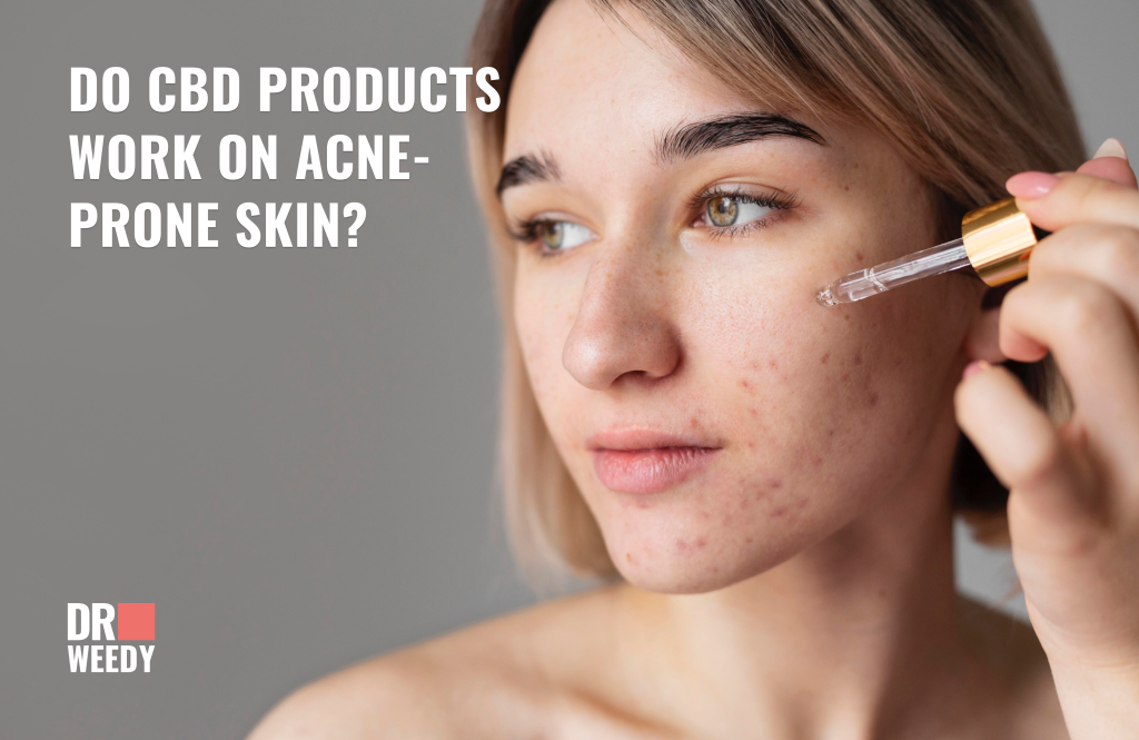 Do CBD products work on acne-prone skin?