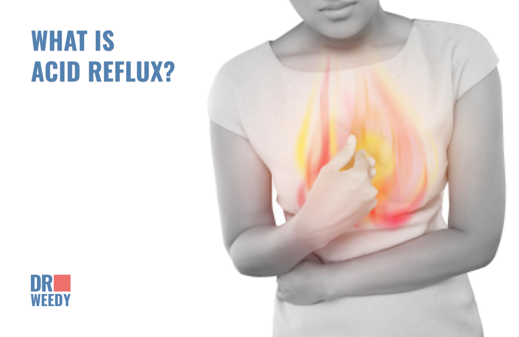 What is acid reflux?