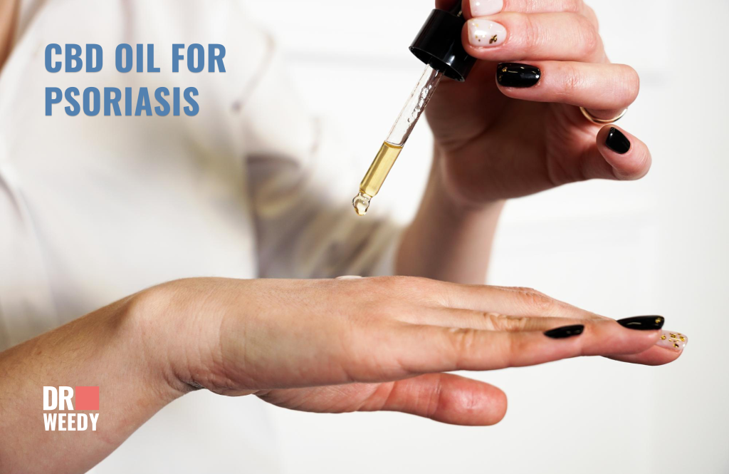 Can CBD Oil really treat psoriasis?