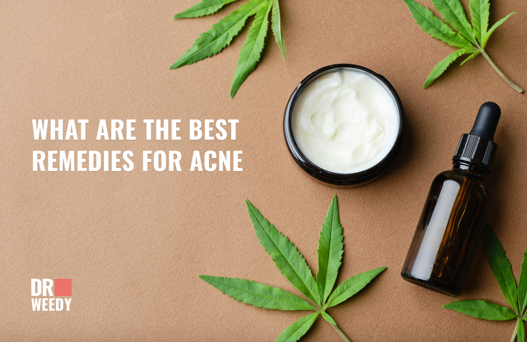 What are the best remedies for acne