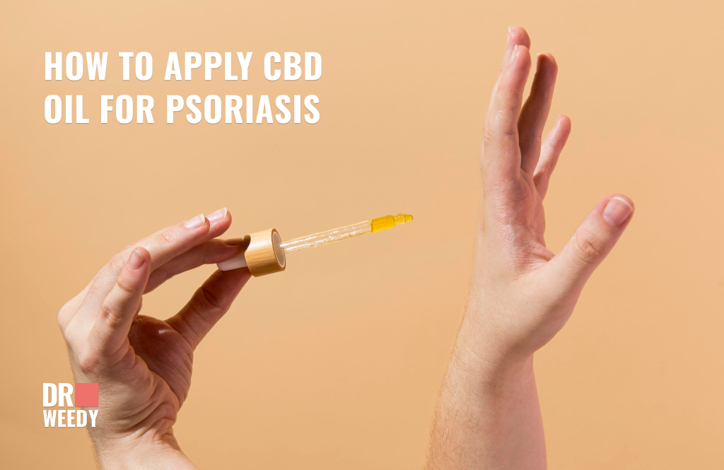 How to apply CBD oil for psoriasis