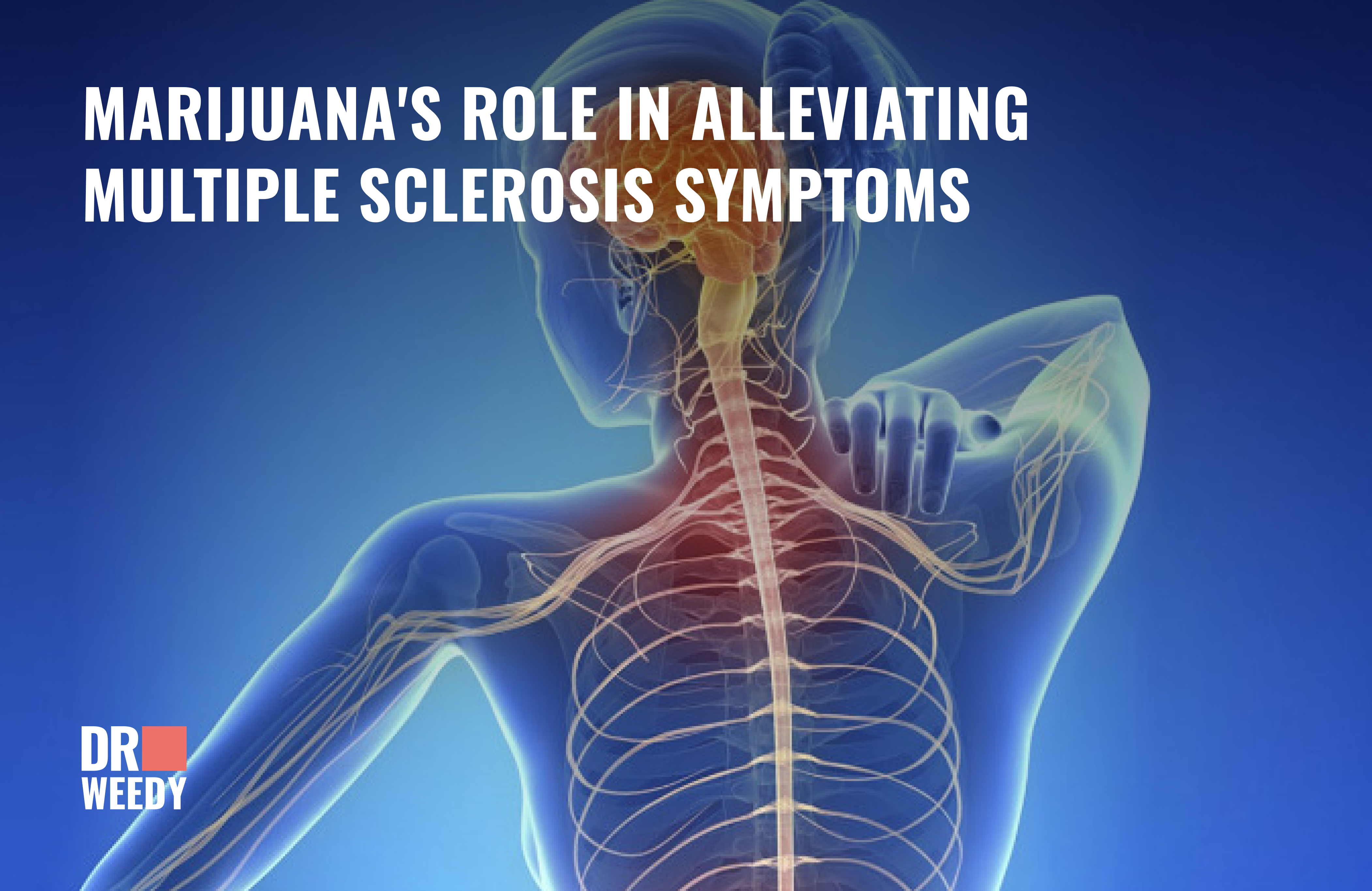 Marijuana's Role in Alleviating Multiple Sclerosis Symptoms