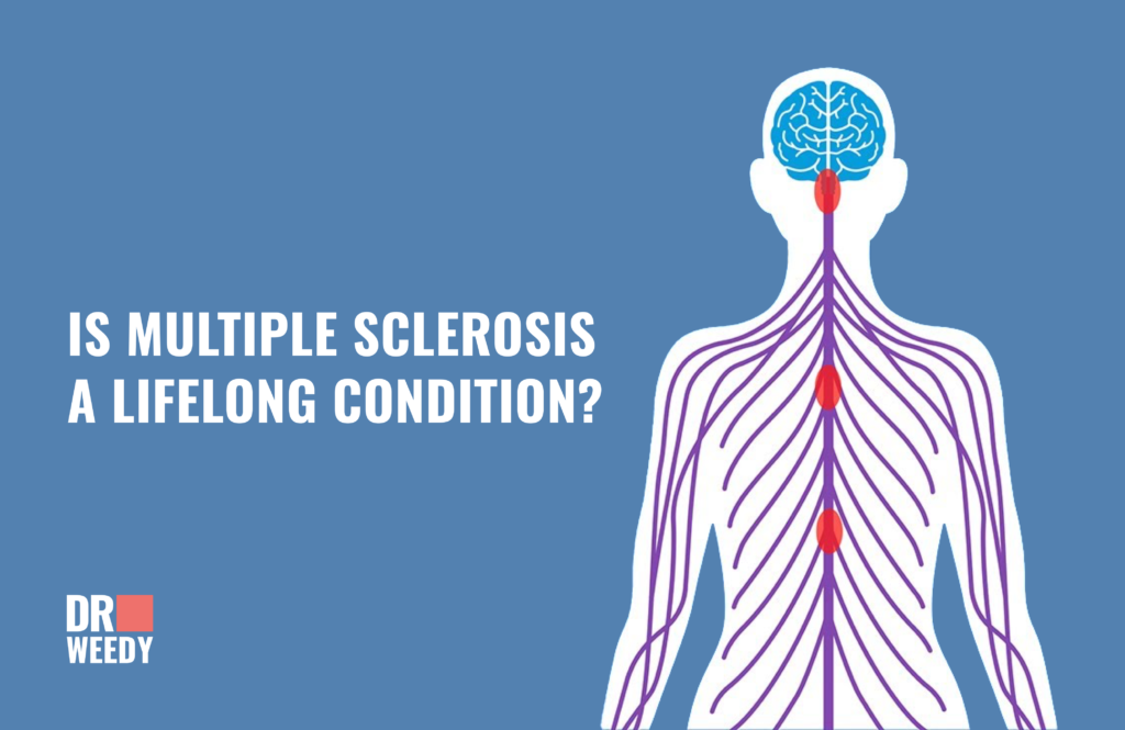 Is Multiple Sclerosis a Lifelong Condition?